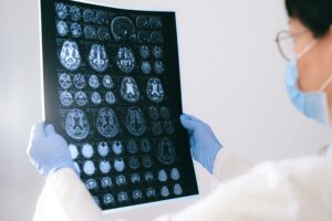 A Person hält Aufnahmen eines MRT des Gehirns